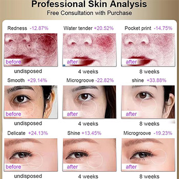 home facial LED mask.jpg